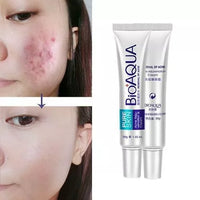 COMBO ANTI ACNE BIOAQUA+ CAJA DE SEGURIDAD