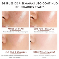 Serum Facial Antiacné de Ácido Salicílico Bioaqua