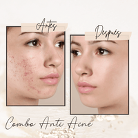 COMBO anti acne SALICILICO