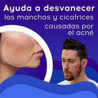 Crema Cicatrizante Antiacne Bioaqua