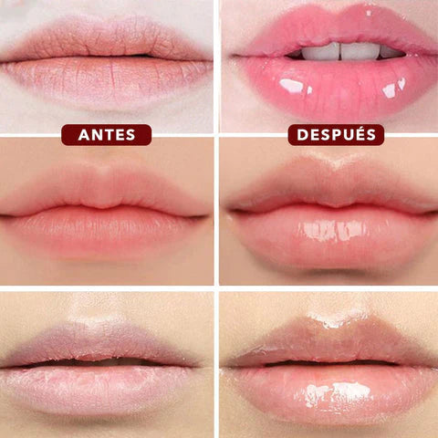 VOLUMINIZADOR DE LABIOS