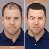 Toppík Fibra Capilar