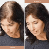 Toppík Fibra Capilar