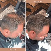 Toppík Fibra Capilar